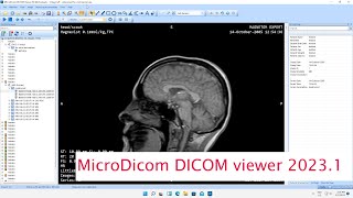 MicroDicom DICOM Viewer 20231 [upl. by Jezebel]