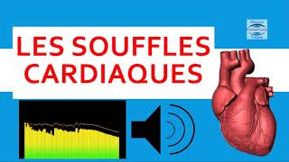 ❤ Souffle au coeur écoutez les bruits cardiaques anormaux auscultation audio cours cardiologie [upl. by Neelat]