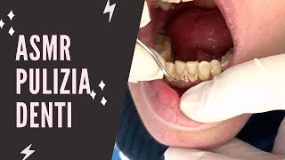 ASMR Pulizia dei DENTI manuale😱 rimuovo tartaro con SCALER [upl. by Eedna]