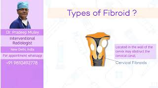 Symptoms of fibroids and various treatment options [upl. by Madella]