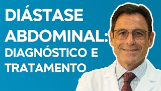 DIÁSTASE ABDOMINAL Sintomas Diagnóstico Causas e Tratamentos [upl. by Evets41]