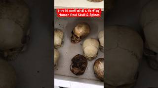 इंसान की असली खोपड़ी अंदर से कैसी होती है । Human Real Skull amp Spine shorts [upl. by Miehar]