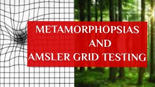 METAMORPHOPSIAS and AMSLERS GRID TESTING [upl. by Jamey844]