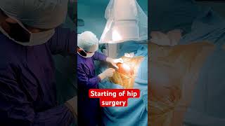 Live surgery for hip [upl. by Deina333]