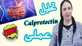 تحليل كالبروتكتن calprotectin عملى👍 [upl. by Redienhcs]