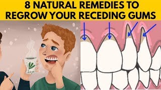 👅8 EASY Ways to GROW BACK Your Receding Gums Naturally AT HOME [upl. by Devy344]