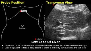 Abdominal Gynecological amp Obstetric Ultrasound Probe Positioning  Transducer Placement USG Scan [upl. by Ford]