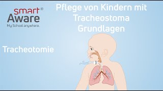 Pflege von Kindern mit Tracheostoma Tracheotomie  Pflegestandards Kinderkrankenpflege  smartAware [upl. by Lanrev]