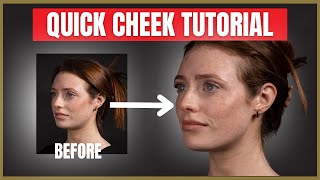 Quick Cheek Filler Tutorial  Cheek Dermal Filler Injection Advice [upl. by Lecia]