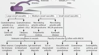 Dr Ayman Elsayed  Cutaneous Vasculitis Part 1  7122017 [upl. by Mini]