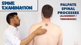 Spine Examination  OSCE Guide old version  UKMLA  CPSA [upl. by Anallise399]