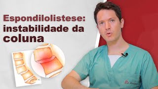 Espondilolistese instabilidade da coluna causada por luxação vertebral [upl. by Mellitz]