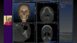 Evol Dicom Viewer  Funções Básicas  Parte 1 [upl. by Cowley]