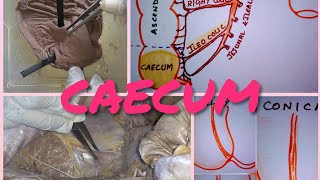 Anatomy of CAECUM [upl. by Willi41]