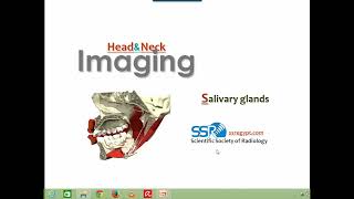 Imaging of Salivary glands DRE Prof Mamdouh Mahfouz [upl. by Orford547]