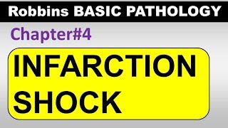 Chp4 Part3 Robbins Basic Patho  Infarction  Shock  General Pathology [upl. by Zanas]