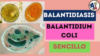 BALANTIDIASIS  BALANTIDIUM COLI EXPLICACIÓN RESUMIDA [upl. by Bradwell]