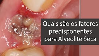 Quais são os fatores predisponentes para Alveolite Seca  Odontologia  Dra Bianca Rosa [upl. by Eytak388]