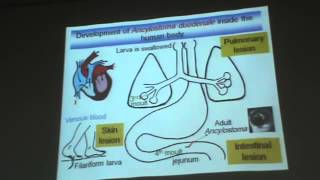 Dr Azza Helminths Nematodes 3 Ancylostoma Duodenale amp Trichostrongylus Colubriformis YouTub [upl. by Eradis]