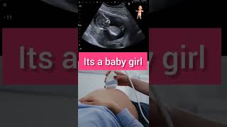 Ultrasound at 12 weeks of pregnancy babygirl ytshorts [upl. by Iline785]