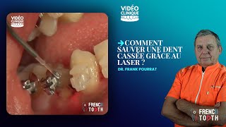 Comment sauver une dent cassée grâce au Laser   Dr Pourrat [upl. by Eikcim458]