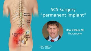 HF10 Spinal Cord Stimulation Part 2 Surgery [upl. by Electra]