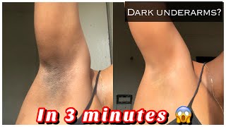 How to Get rid of Dark underarms in 3 minutes instant result [upl. by Aldridge289]