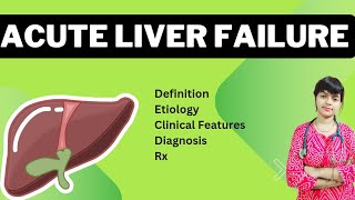 Acute Liver Failure  Fulminant Hepatic Failure  Pediatrics lecture  Clinical Medicine mbbs [upl. by Lehcim]