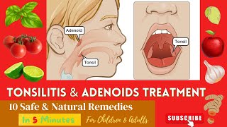 10 Best Effective Proven Home Remedies For Enlarge  Swelling ADENOIDS and TONSILS In Children [upl. by Fons]