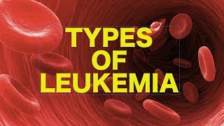 Leukemia  USMLE [upl. by Osanna]