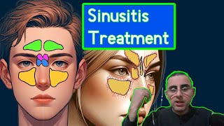 Understanding Chronic Sinusitis Symptoms Causes and Treatment [upl. by Otanod891]