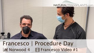 Bethesda Maryland Hair Restoration Clinic Hair Transplant USA  Dr Blumenthal Francesco [upl. by Oibesue]