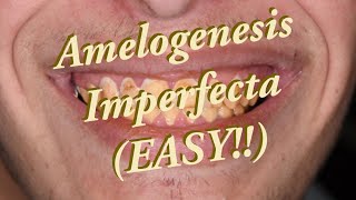 Amelogenesis Imperfecta SIMPLIFIED [upl. by Elia]