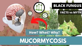 Mucormycosis Causes Transmission Risk factors Symptoms Diagnosis Treatment  Black Fungus [upl. by Nylemaj]