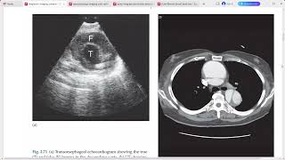 DIAGNOSTIC RADIOLOGY IMAGING [upl. by Wells856]