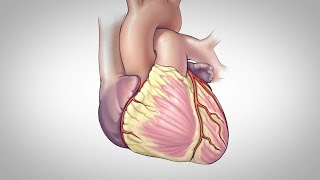 Coronary Artery Bypass Surgery [upl. by Bala]