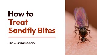 How to Treat Sandfly Bites Effectively Discover the Proven Method [upl. by Gibbon]