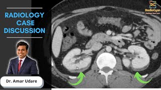 PACSbased Radiology Case Review  Dr Amar Udare  Aug 2021 [upl. by Ellehcam682]