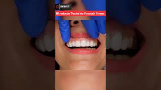 Microdontia Small size Teeth Treated via Porcelain Veneers shorts veneers dentition viral [upl. by Iznyl]