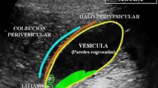 02 Ecografía Hepatobiliopancreática Fundamentos Básicos [upl. by Eilsil]