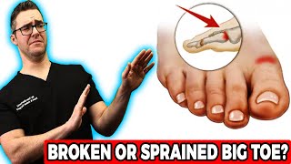 Broken Big Toe or Sprained Big Toe Joint BEST Home Treatment 2022 [upl. by Chev]