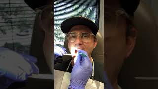 Marsupialization of oral ranula aka removing bubble under tongue [upl. by Karlen]