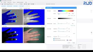 RWD RFLSI ZW Laser Speckle Imaging SystemAcquisition [upl. by Eybbob466]