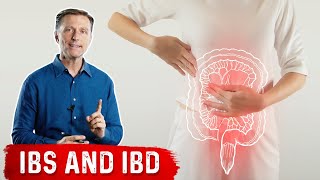 FODMAPS and Irritable Bowel Syndrome [upl. by Aivatnuhs]