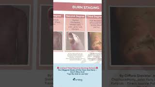 Understanding Burn Staging for Nursing Students 🌟 [upl. by Eednil]