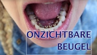 Onzichtbare beugel strakker zetten  FURROWNL [upl. by Yrruc]