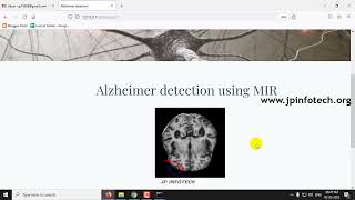 Alzheimer’s Disease Detection using Deep Learning  Python Final Year Project 2023 [upl. by Aremmat720]