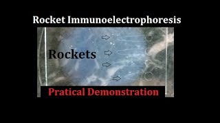 Rocket Immunoelectrophoresis Teaching kit [upl. by Ennaxxor]