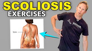 5 Scoliosis Rehab Exercises [upl. by Wylen]