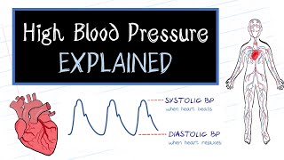 What is High Blood Pressure HealthSketch [upl. by Mastat]